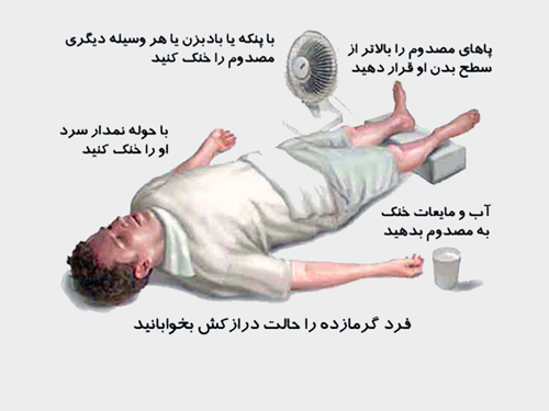 گرمازدگی