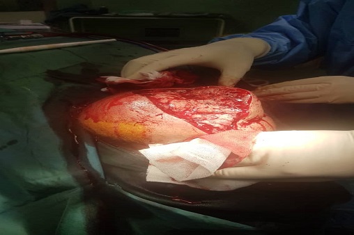 عمل جراحی خبر ماهشهر 3