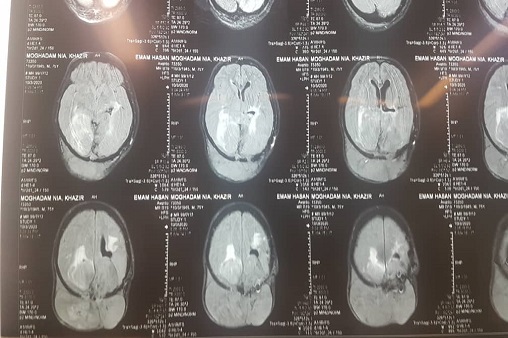 عمل جراحی خبر ماهشهر 5